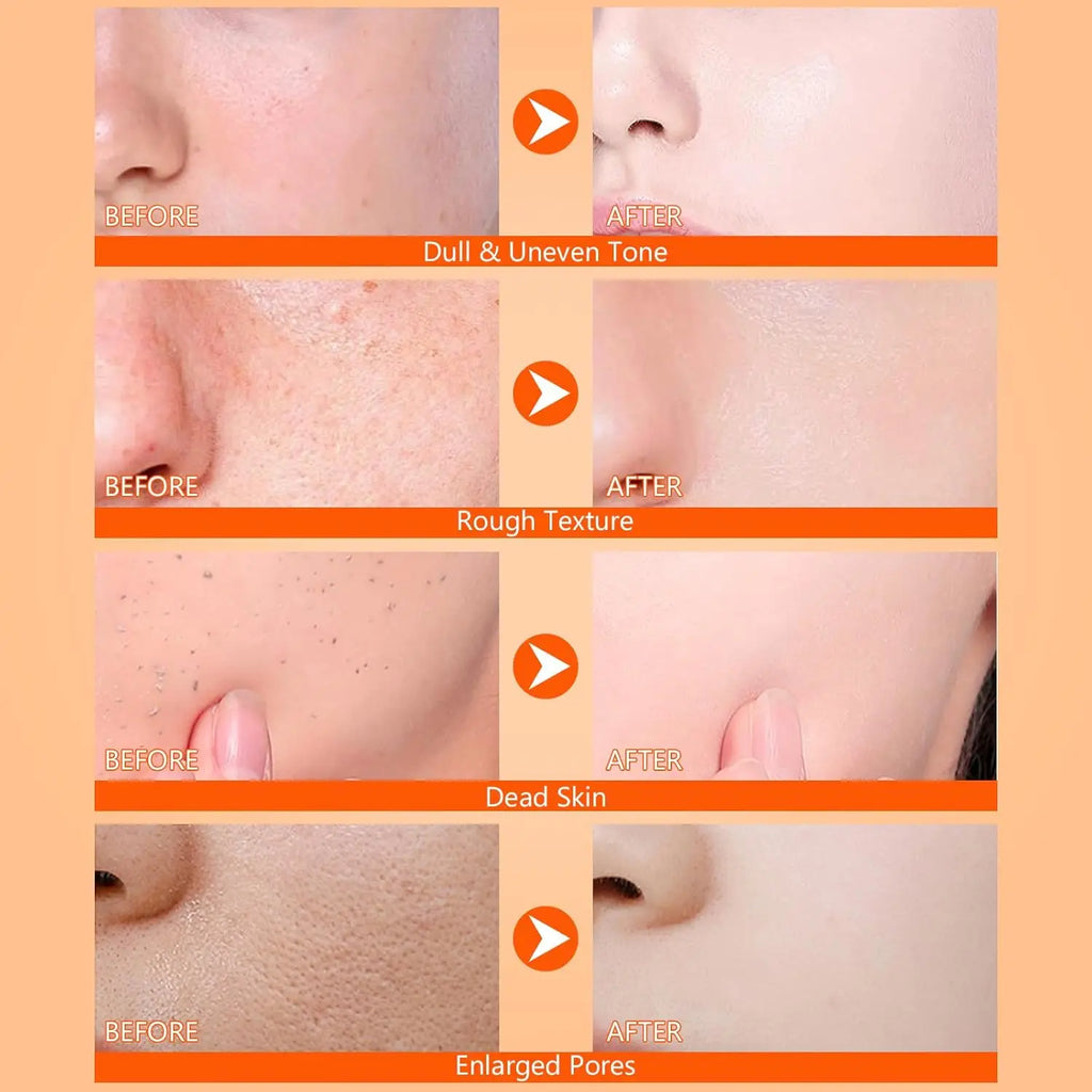 Body Keratin Care Kojic Acid Turmeric Spray Gently Exfoliating Peeling Solution Nourishing Hydrating Skin Care All Skin Types